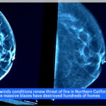Image of Breast Imaging form SBH Women's Health Center