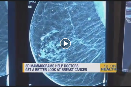 3D Mammography Image